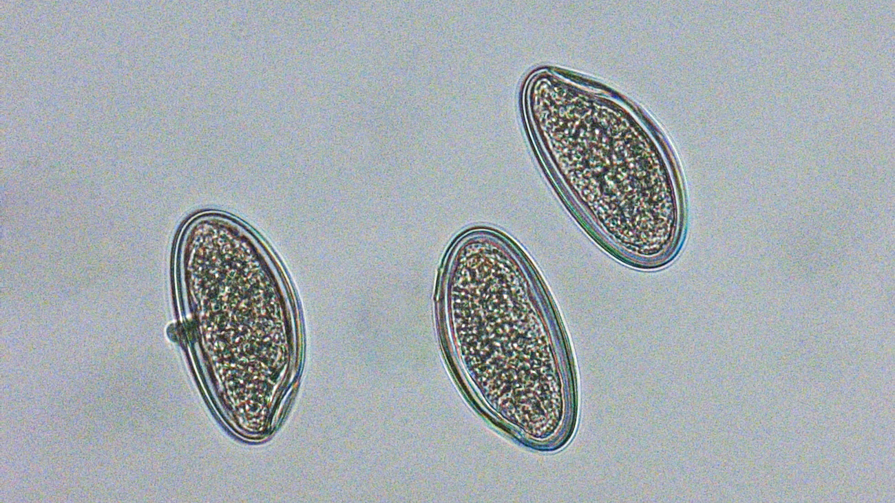 Gli Ossiuri Microbias